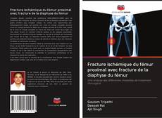Portada del libro de Fracture ischémique du fémur proximal avec fracture de la diaphyse du fémur