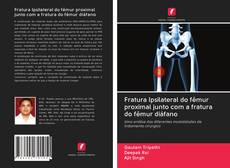 Buchcover von Fratura Ipsilateral do fêmur proximal junto com a fratura do fêmur diáfano