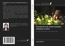 Bookcover of Prevalencia de enfermedades alérgicas y asma