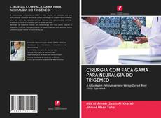 Bookcover of CIRURGIA COM FACA GAMA PARA NEURALGIA DO TRIGÉMEO