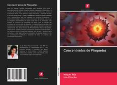 Concentrados de Plaquetas kitap kapağı