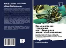 Buchcover von Новый алгоритм управления протуберанцами дерматофибросаркомы