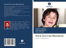 Bookcover of Post & Core in den Milchzähnen