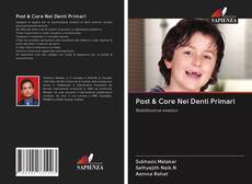 Buchcover von Post & Core Nei Denti Primari