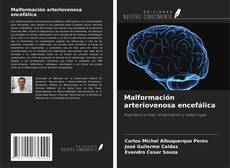 Capa do livro de Malformación arteriovenosa encefálica 