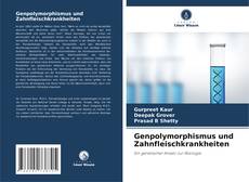 Buchcover von Genpolymorphismus und Zahnfleischkrankheiten