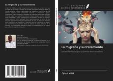 Capa do livro de La migraña y su tratamiento 