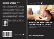 Bookcover of Métodos de evaluación de la curación de las heridas
