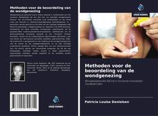 Bookcover of Methoden voor de beoordeling van de wondgenezing