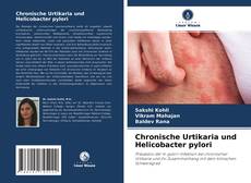 Capa do livro de Chronische Urtikaria und Helicobacter pylori 