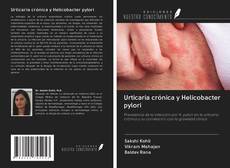 Capa do livro de Urticaria crónica y Helicobacter pylori 