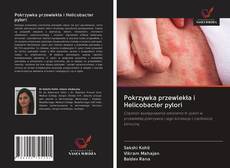 Copertina di Pokrzywka przewlekła i Helicobacter pylori