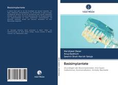 Bookcover of Basisimplantate
