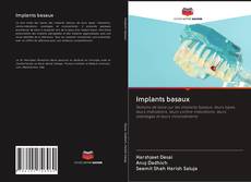 Bookcover of Implants basaux