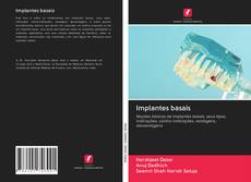Capa do livro de Implantes basais 