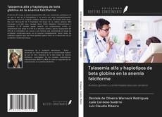 Bookcover of Talasemia alfa y haplotipos de beta globina en la anemia falciforme