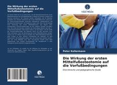 Bookcover of Die Wirkung der ersten Mittelfußosteotomie auf die Vorfußbedingungen