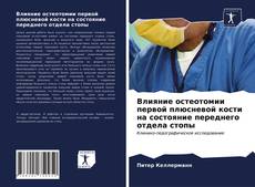 Bookcover of Влияние остеотомии первой плюсневой кости на состояние переднего отдела стопы