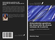 Bookcover of Antecedentes genéticos del desarrollo de úlceras venosas de la pierna