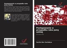 Couverture de Postępowanie w przypadku raka jamy ustnej