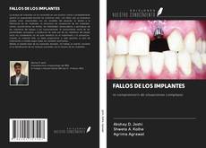 Buchcover von FALLOS DE LOS IMPLANTES