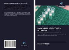 Copertina di BIOMARKERS BIJ COLITIS ULCEROSA