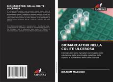 Buchcover von BIOMARCATORI NELLA COLITE ULCEROSA