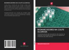 BIOMARCADORES NA COLITE ULCEROSA kitap kapağı