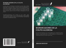 Bookcover of BIOMARCADORES EN LA COLITIS ULCEROSA