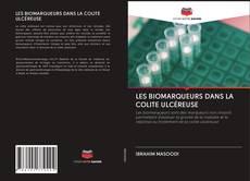 Bookcover of LES BIOMARQUEURS DANS LA COLITE ULCÉREUSE