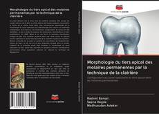 Bookcover of Morphologie du tiers apical des molaires permanentes par la technique de la clairière