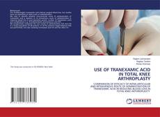 Copertina di USE OF TRANEXAMIC ACID IN TOTAL KNEE ARTHROPLASTY