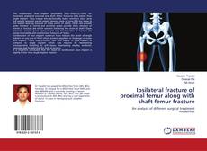 Bookcover of Ipsilateral fracture of proximal femur along with shaft femur fracture