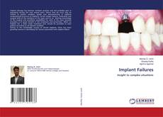 Copertina di Implant Failures