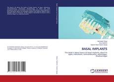 Bookcover of BASAL IMPLANTS