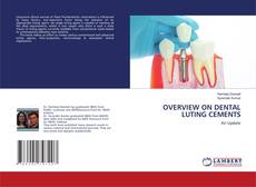 Copertina di OVERVIEW ON DENTAL LUTING CEMENTS