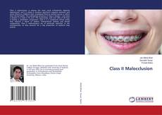 Copertina di Class II Malocclusion