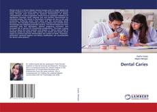 Copertina di Dental Caries