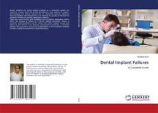 Copertina di Dental Implant Failures