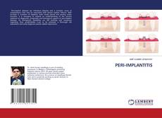 Copertina di PERI-IMPLANTITIS