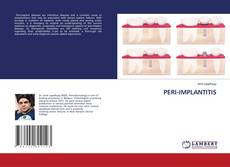 Copertina di PERI-IMPLANTITIS