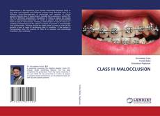 Copertina di CLASS III MALOCCLUSION