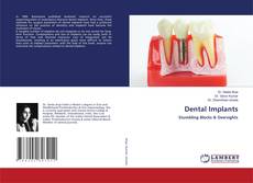 Copertina di Dental Implants