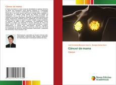 Buchcover von Câncer de mama