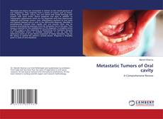 Copertina di Metastatic Tumors of Oral cavity