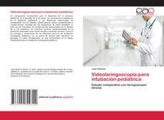 Copertina di Videolaringoscopía para intubación pediátrica