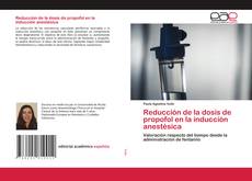 Couverture de Reducción de la dosis de propofol en la inducción anestésica