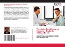Tendinitis Calcificada de Hombro y Onda de Choque Focal kitap kapağı