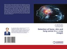 Copertina di Detection of bone, skin and lung cancer in a x-ray images