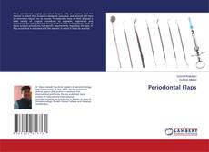 Copertina di Periodontal Flaps